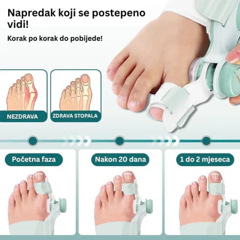 Ortopedsko Pomagalo Za Stopala 2